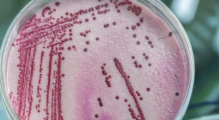 Groźna bakteria w jasielskim szpitalu!  W piątek Sanepid pobierze kolejne próbki